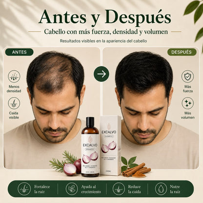 Frena la caída desde la raíz con Excalvo Shampoo USA