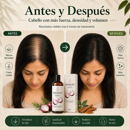 Frena la caida desde la raiz con EXCALVO Shampoo USA